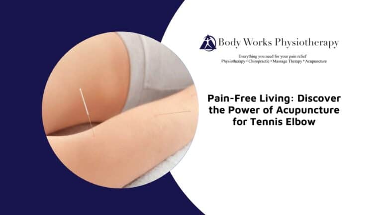 Pain-Free Living: Discover the Power of Acupuncture for Tennis Elbow