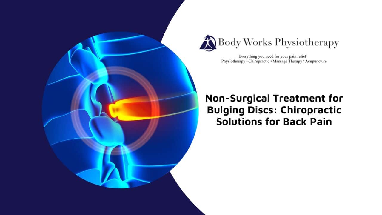 Non-Surgical Treatment for Bulging Discs: Chiropractic Solutions for ...