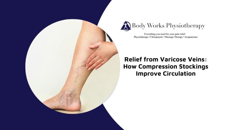 Relief from Varicose Veins: How Compression Stockings Improve Circulation