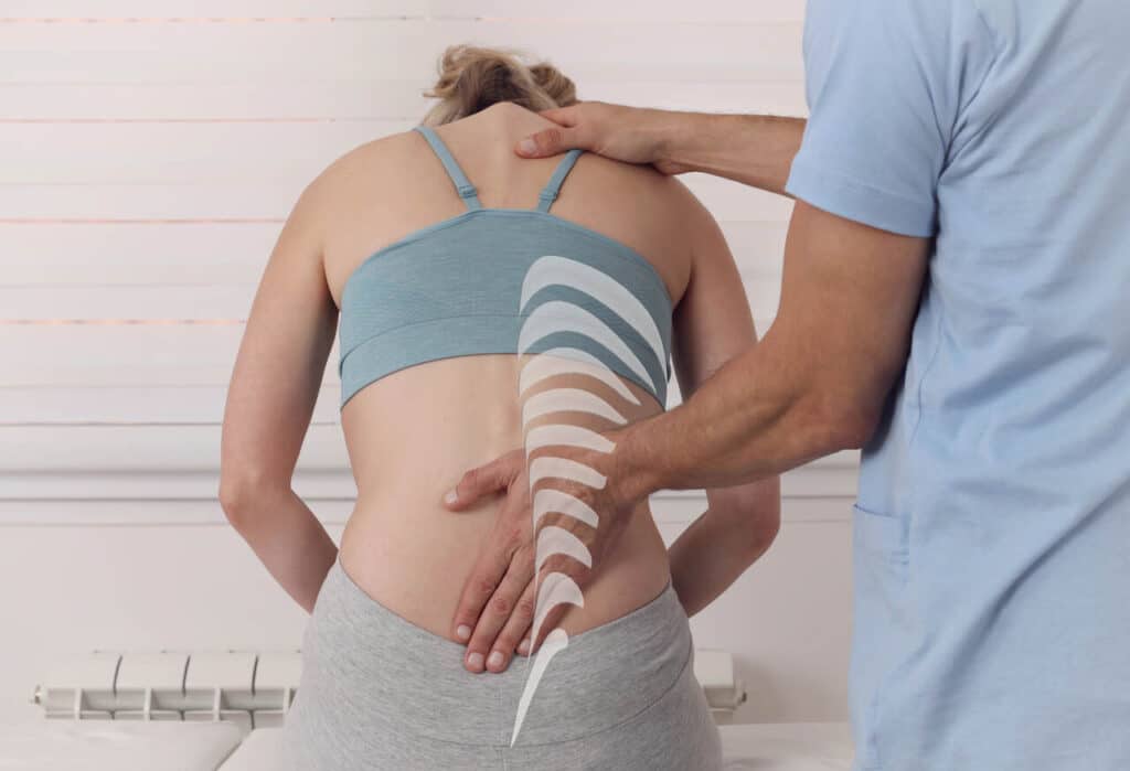 physiotherapy for scoliosis