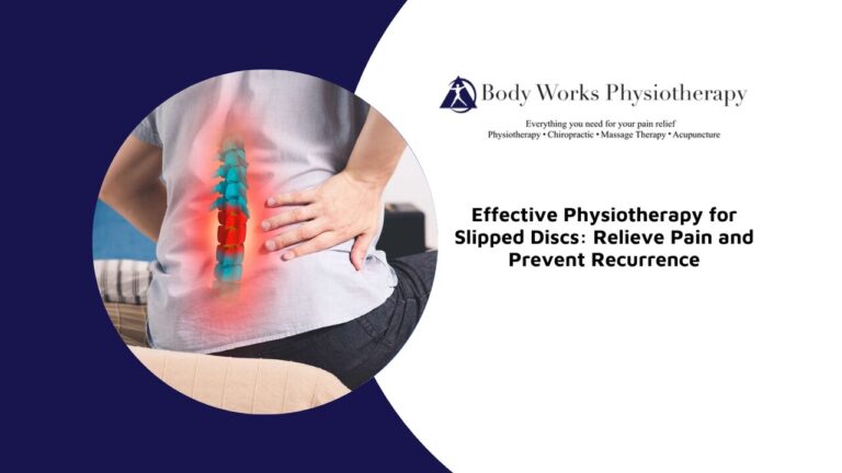 Effective Physiotherapy for Slipped Discs: Relieve Pain and Prevent Recurrence